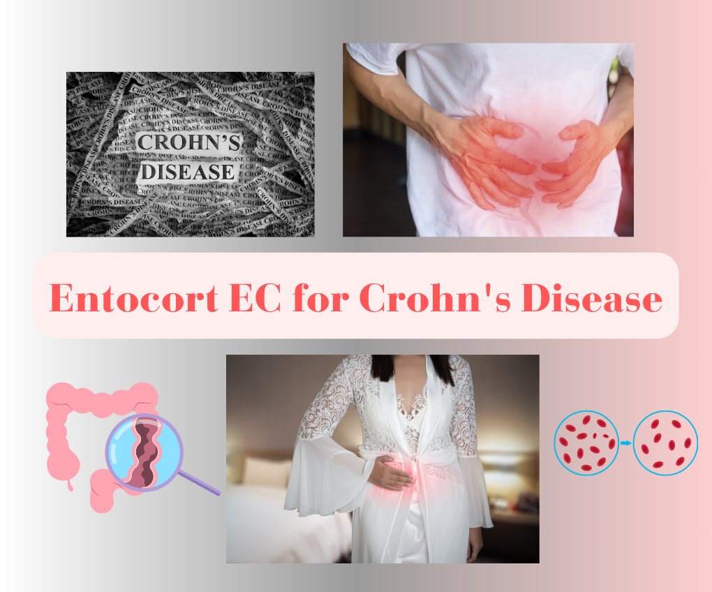 Entocort EC (Budesonide) for Crohn's: How it Works, Side Effects, and Where to Buy